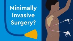 minimally invasive spine (MIS) surgery