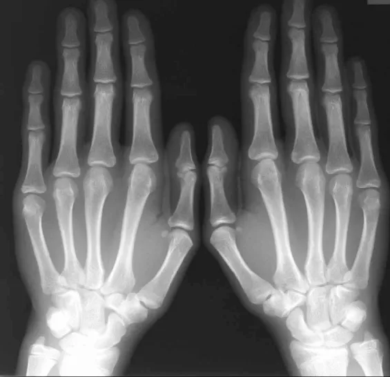 Orthopedic Surgery Clinic Medical Billing