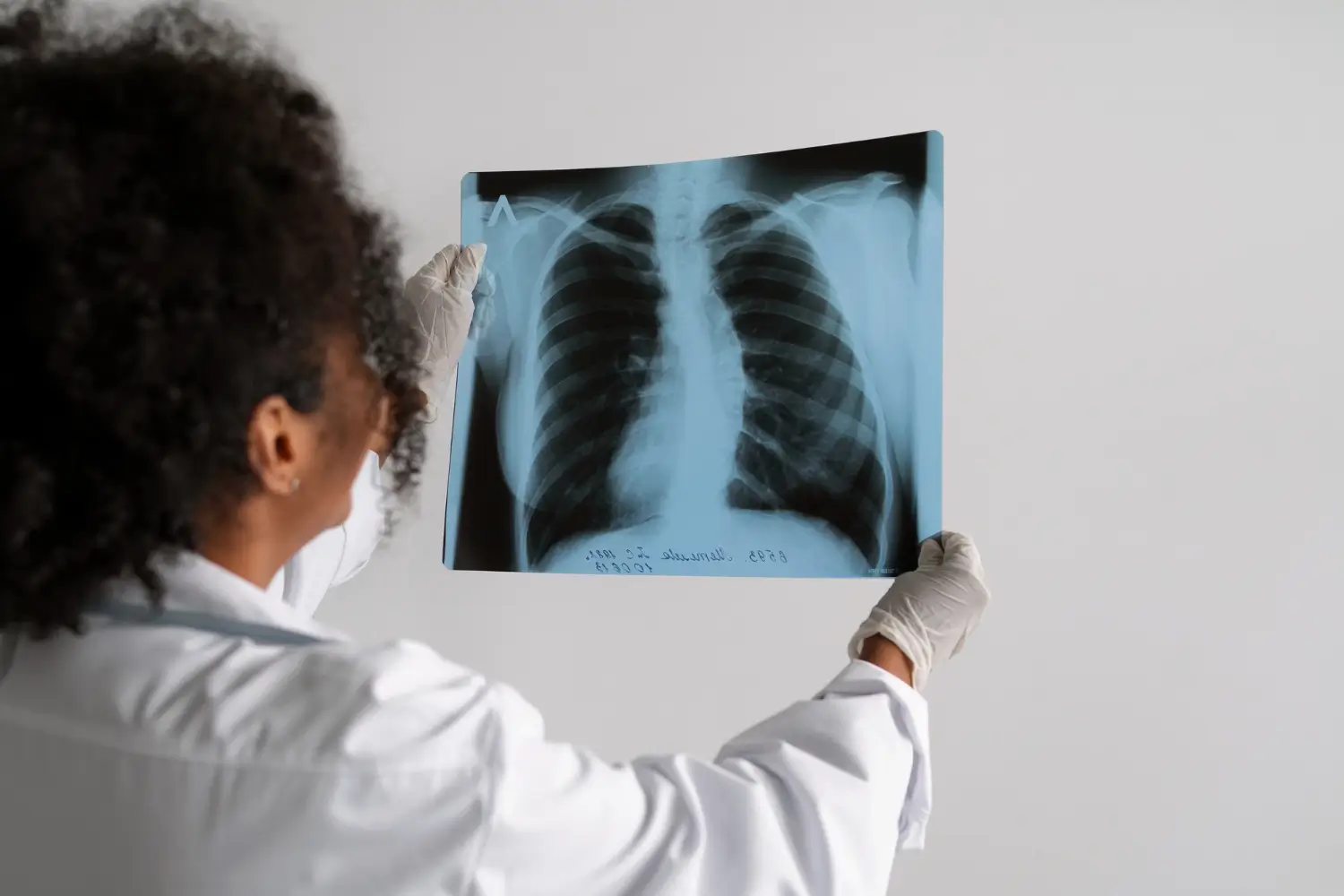 Pulmonology Billing and Coding Specialist
